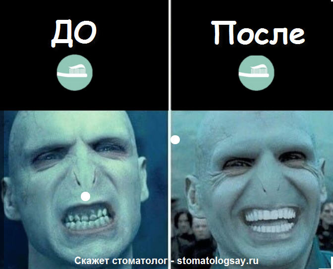 почему важно чистить зубы