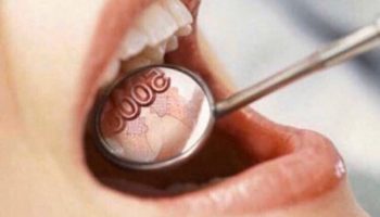 Что видит стоматолог у пациента во рту