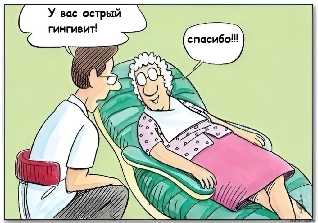 Острый гингивит