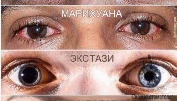 Стоматолог и его глаза